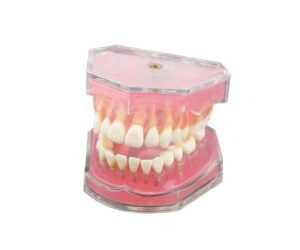 Dentalmall Dental Model with Removable Teeth for Study Review: Is It Worth It?